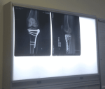 x-ray knee